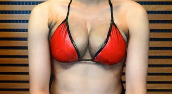 boob's implant level china