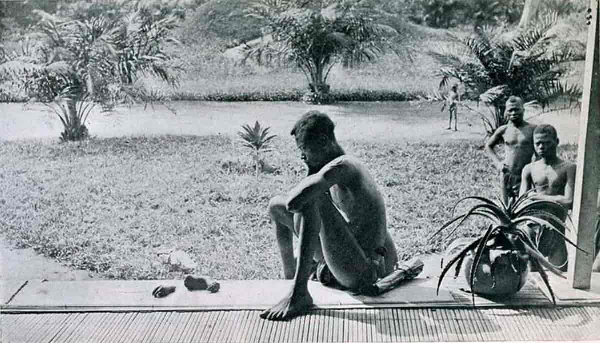 Homme regardant le pied et la main de sa fille de 5 ans, Congo, 1904