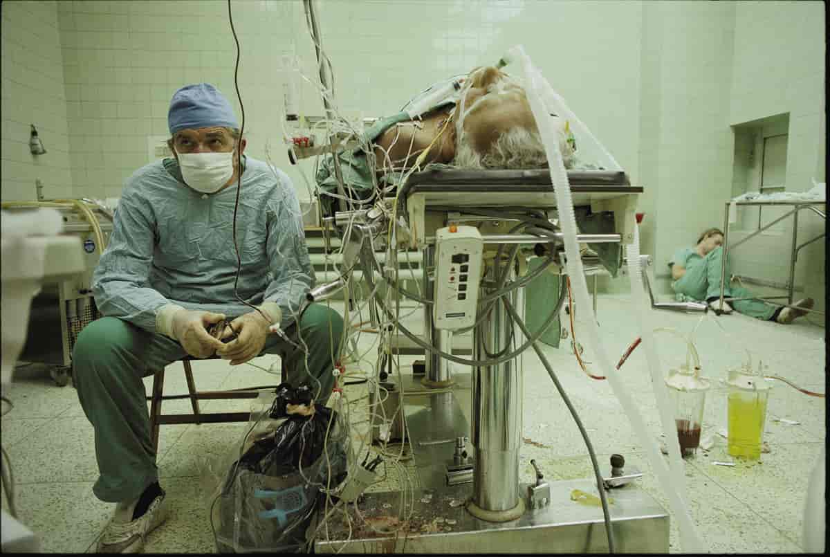 Le docteur Religa veille son patient après 23 heures d'intervention - 1987 Pologne