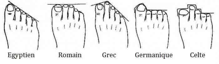 De quelle forme sont vos pieds ?