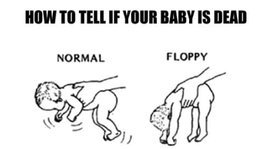 Floppy baby