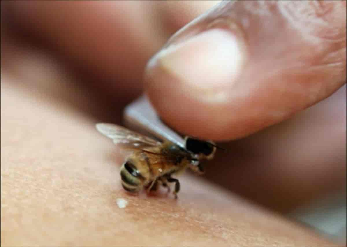 Guérir la SEP avec des abeilles 