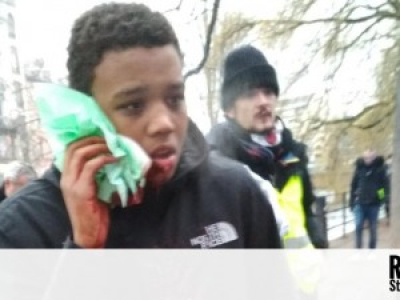 https://www.rue89strasbourg.com/exclu-tir-lbd-lilian-16-ans-strasbourg-plainte-mere-classee-163408