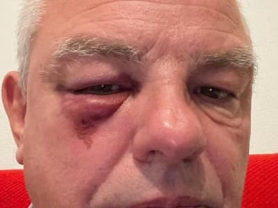 André Mondange, le maire agressé par des «nationalistes»